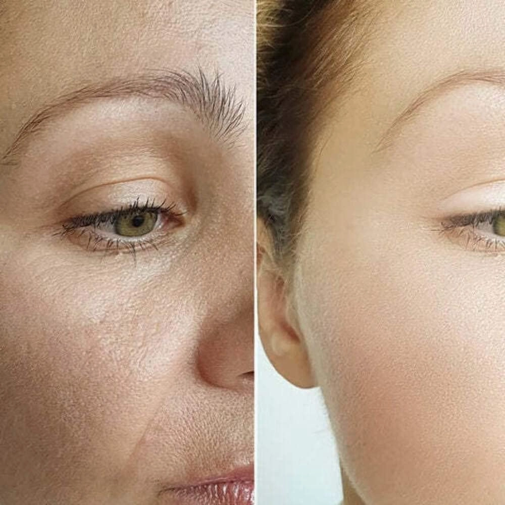 Instant Face Lift Peptide Complex Pomegranate & Orange Blossom Extract Under 400 Daltons 12oz Pouch