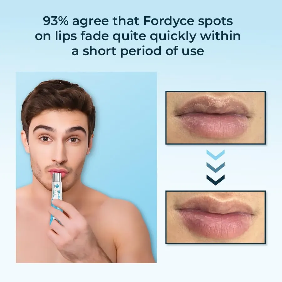 Lip Acne Cream, Fordyce Seeds - Lip Acne, Moisturizes, Improves Dry, Chapped Lips, Reduces Dark Lips - 20ml…