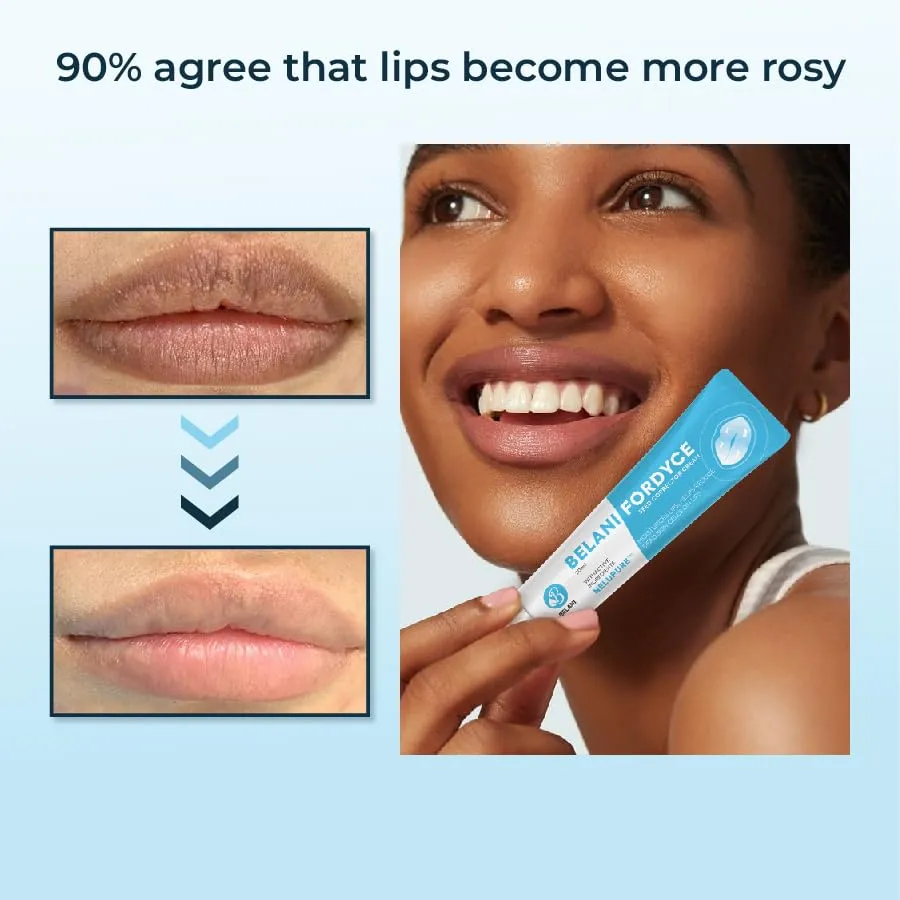 Lip Acne Cream, Fordyce Seeds - Lip Acne, Moisturizes, Improves Dry, Chapped Lips, Reduces Dark Lips - 20ml…