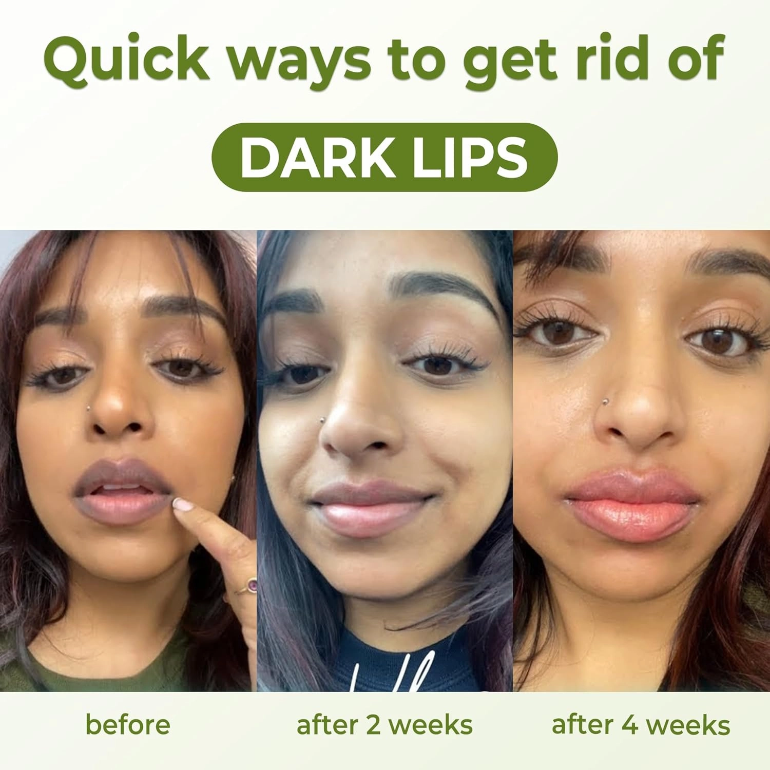 Organic Dark Lip Cream, Lips Balm For Dark Lip For Women & Men, Lip Wrinkle Repair, Lip Moisturizer For Very Dry Lips & Cracked With Super Red Vitamin E, Sunflower Oil, Shea Butter 0.52 Fl Oz