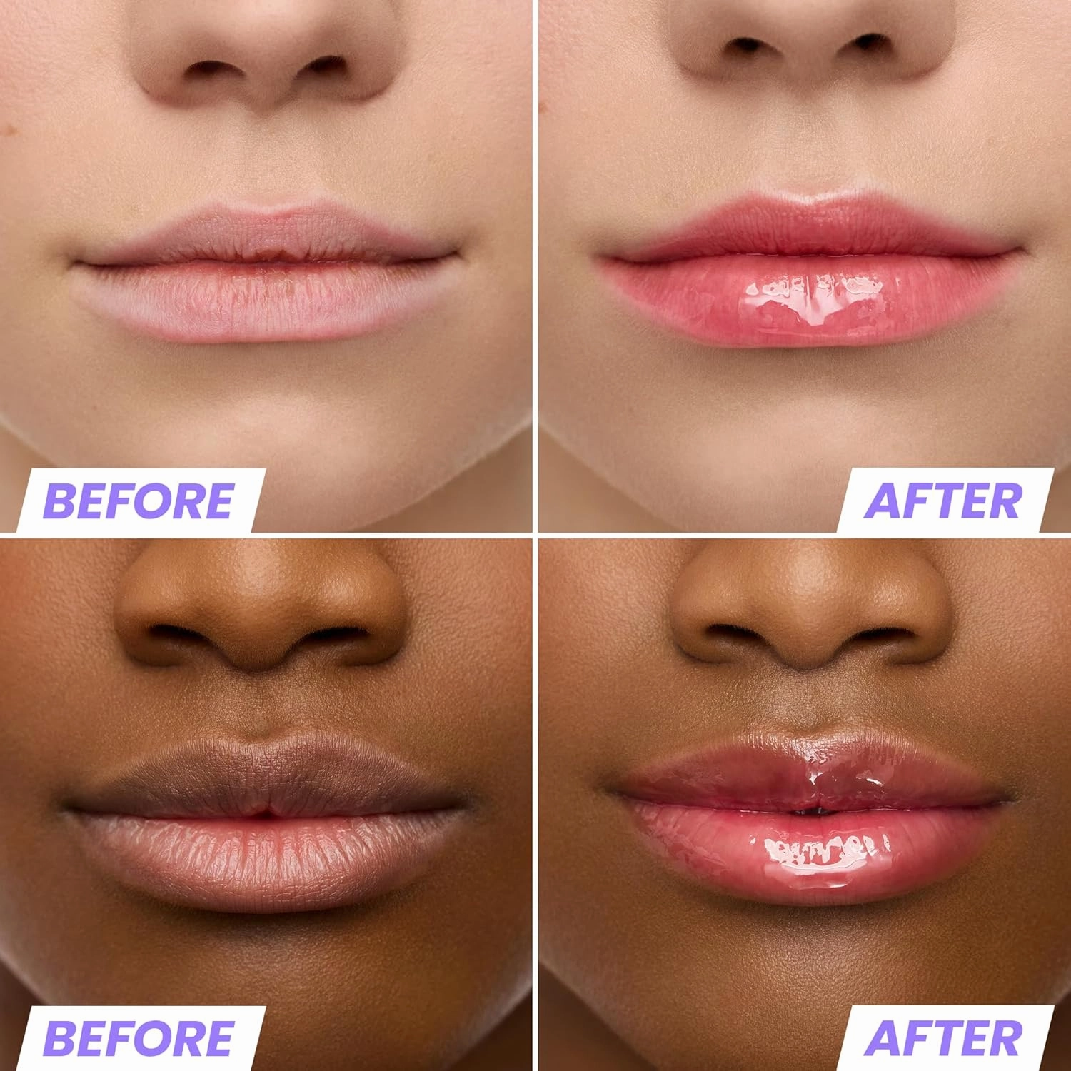 Wonderskin Lip Rehab Serum Oil - Tinted Lip Oil for Women, Hydrating, Moisturizing, and Non-Sticky Red Tint Serum for Dry Lips (Amour)
